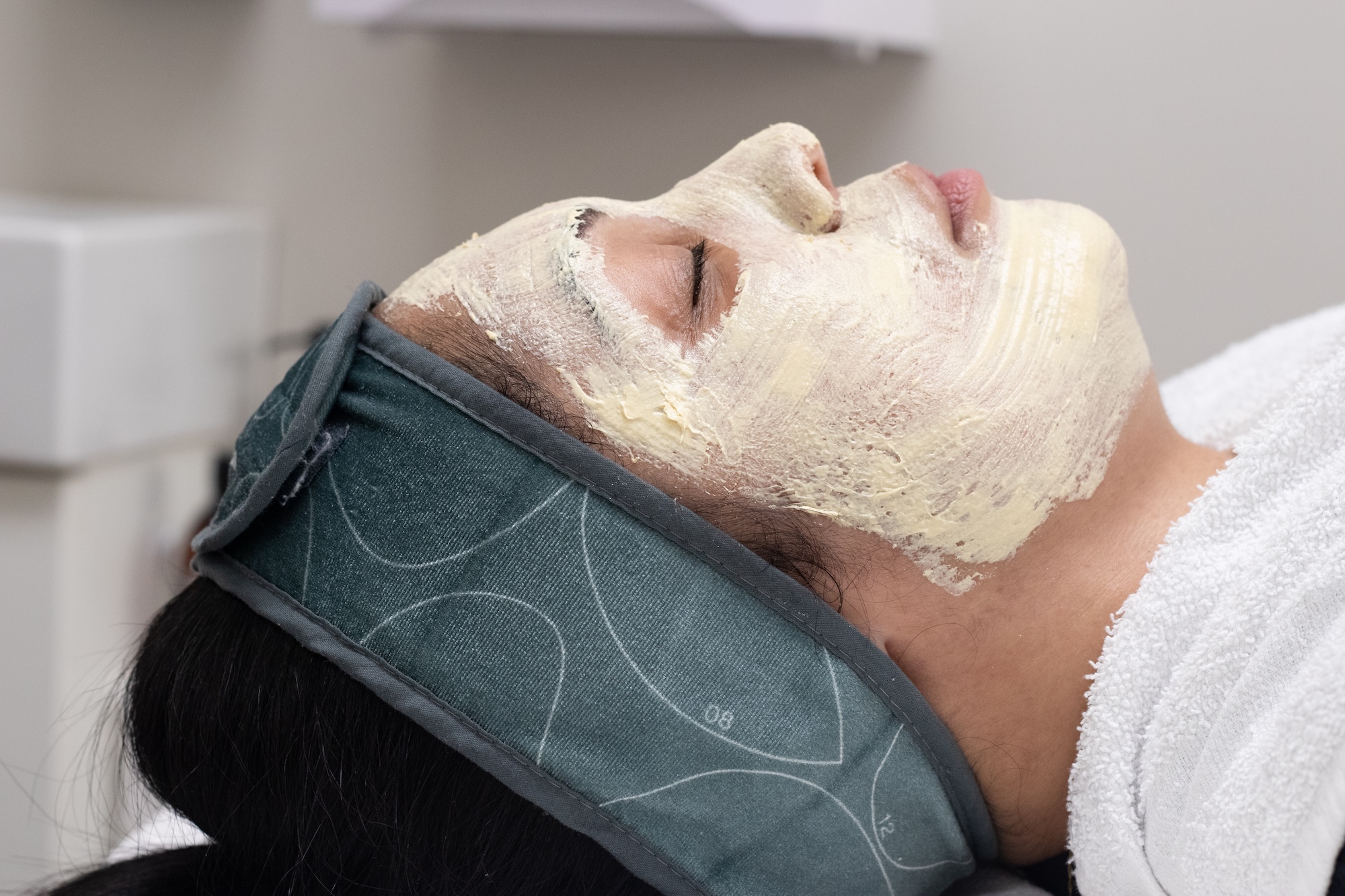A close-up of a patient with a Melano-Pro Peel applied to her face.