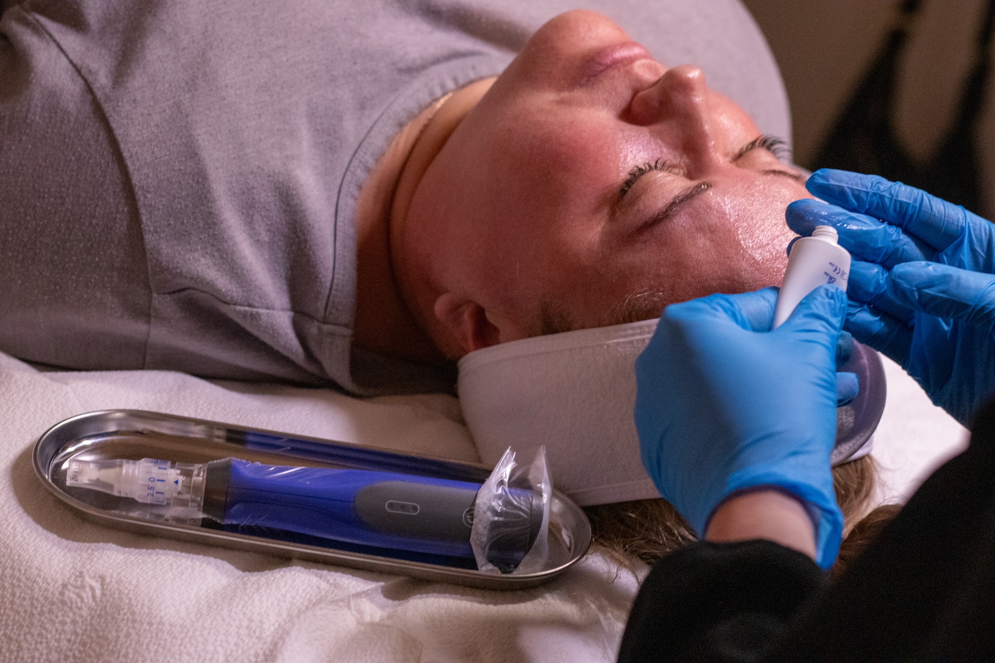 A close-up of a nurse prepping a PDRN microneedling session as a patient lays in the background.