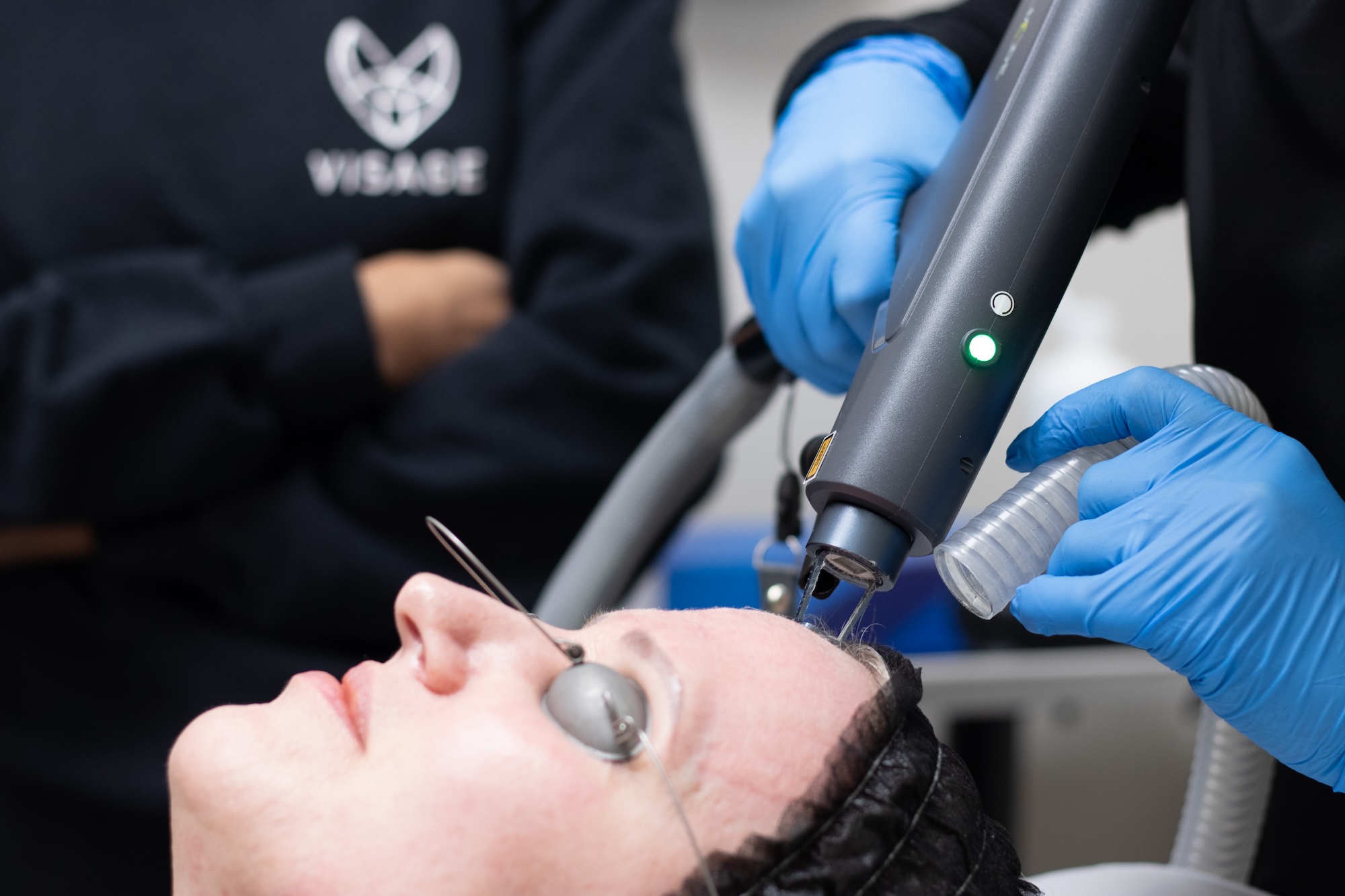 A close-up of a woman's face as she receives a deep laser peel, IPL photofacial wrinkle buster treatment in Winnipeg.