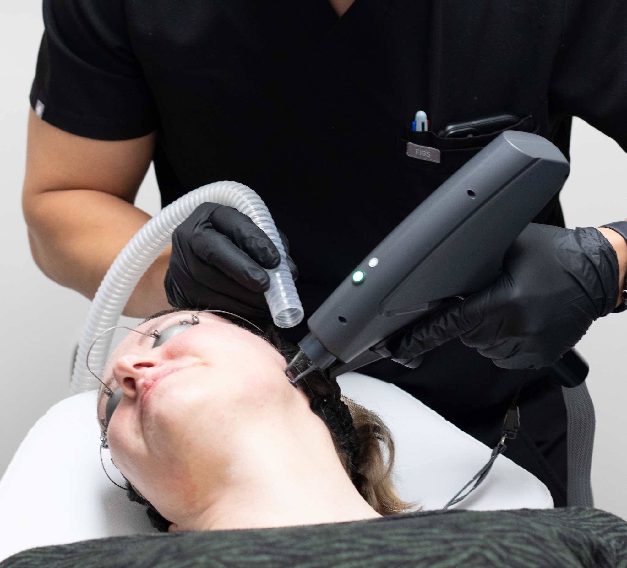 Close-up of a laser tech applying an IPL photofacial laser to a female patient's face.
