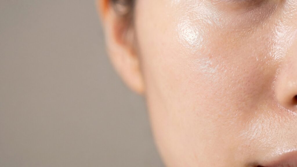 A close-up of a female's skin after face stamping, a viral skincare trend from China.