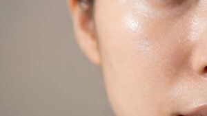 A close-up of a female's skin after face stamping, a viral skincare trend from China.