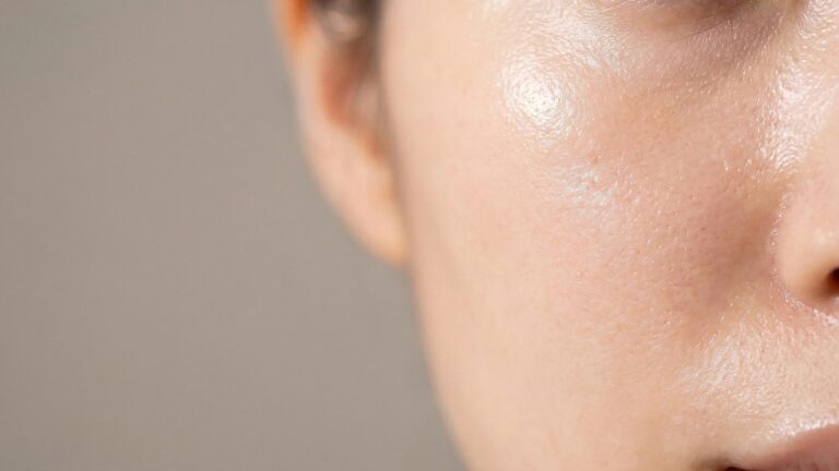 A close-up of a female's skin after face stamping, a viral skincare trend from China.